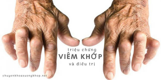 Những triệu chứng gây viêm khớp phổ biến Những triệu chứng gây viêm khớp phổ biến