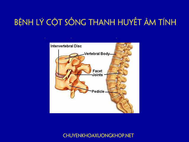  bệnh lý cột sống huyết thanh âm tính