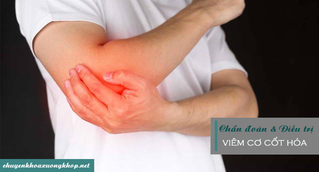 Chuẩn đoán và điều trị viêm cơ cốt hóa