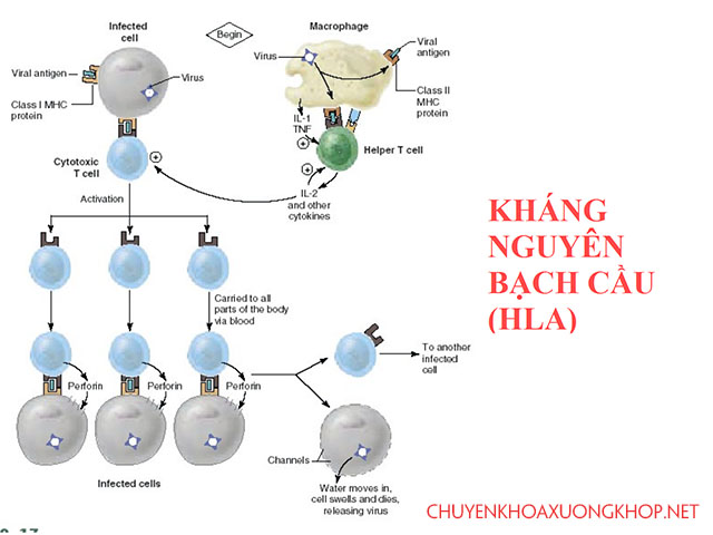 Nguyên nhân gây bệnh lý cột sống huyết thanh âm tính