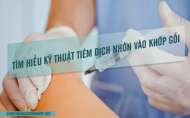 Kỹ thuật tiêm dịch nhờn vào khớp gối là gì?