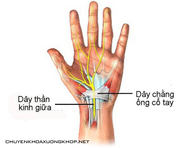 Tê mỏi chân tay do hội chứng ống cổ tay - tê nhức chân tay đau mỏi vai gáy