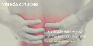 Bệnh vôi hóa cột sống - đừng để nỗi đau thêm dài