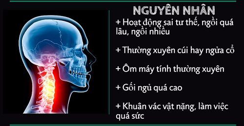 Bệnh vôi hóa cột sống 