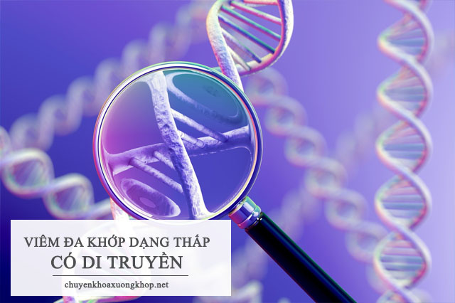 Bệnh viêm đa khớp dạng thấp có di truyền không?