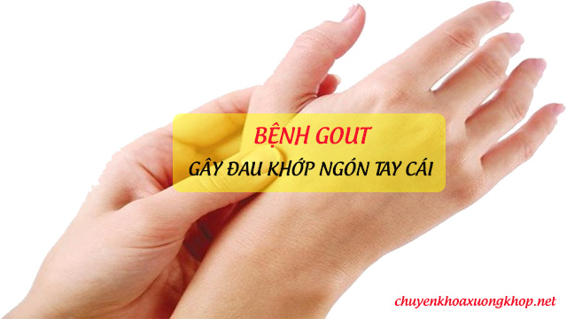 Nguyên nhân gây đau khớp ngón tay cái