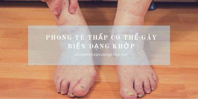 Biến chứng phong tê thấp