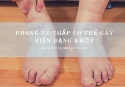 Cách chữa trị bệnh phong tê thấp bằng thuốc dân gian