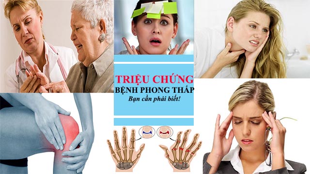 Dấu hiệu bệnh phong thấp