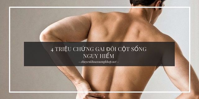 Triệu chứng gai đôi cột sống không phải ai cũng biết