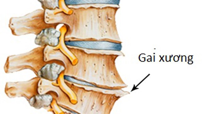 gai-doi-cot-song-nguyen-nhan-do-dau1