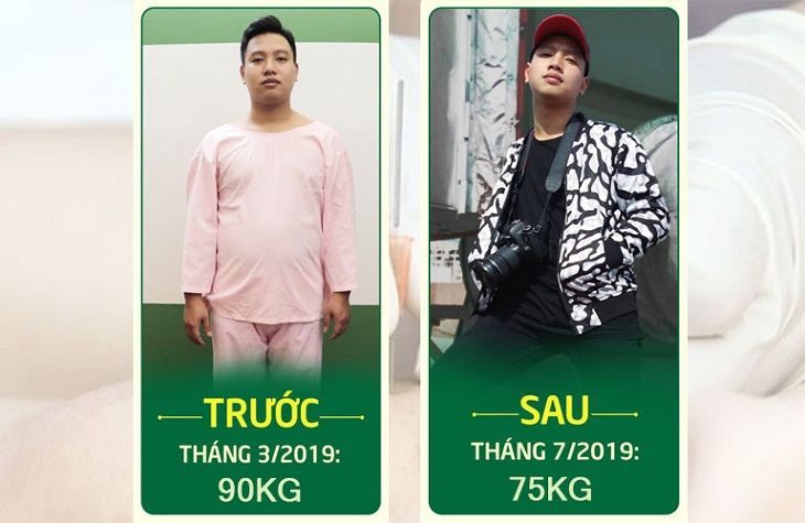 Thành Trung đã giảm thành công 15kg mỡ thừa nhờ cấy chỉ Đông phương Y pháp