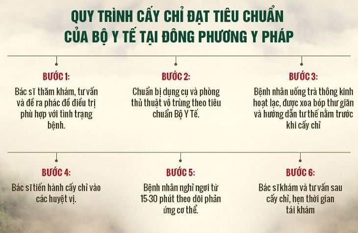 Quy trình cấy chỉ chuyên biệt, khoa học và đảm bảo vô trùng