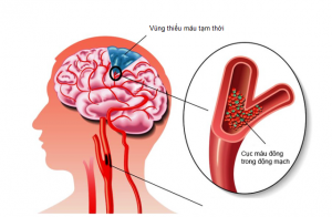 thoai-hoa-dot-song-co-co-the-gay-thieu-mau-nao-ban-da-biet2