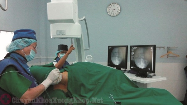 một số phương pháp mổ thoát vị đĩa đệm tại bệnh viện 108