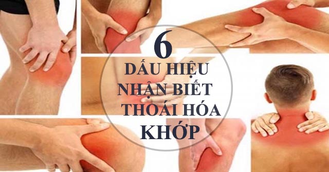 Dấu hiệu nhận biết thoái hóa khớp