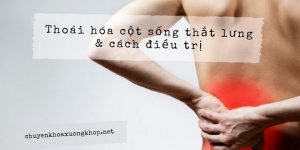 Thuốc điều trị bệnh thoái hóa cột sống thắt lưng nào là hiệu quả?