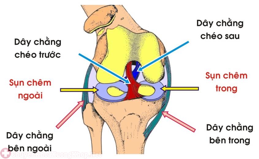 đứt dây chằng chéo trước và rách sụn chêm