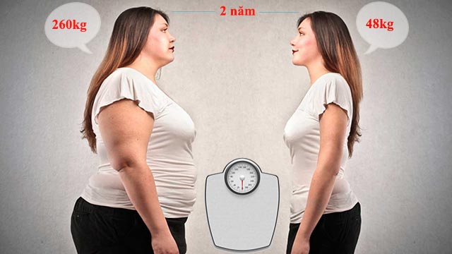 Thừa cân gây thoái hóa khớp Thừa cân gây thoái hóa khớp