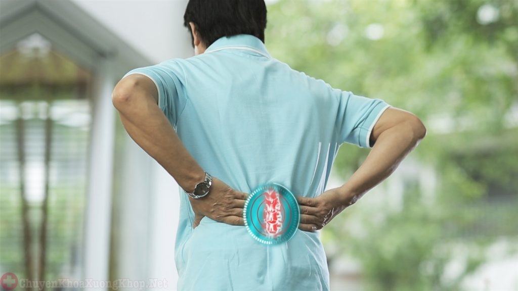 Bệnh thoát vị đĩa đệm gây đau lưng
