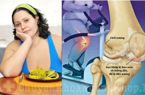 Các nguyên nhân gây thoái hóa khớp háng cần cảnh giác