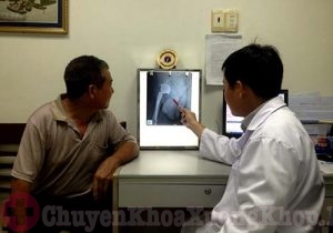 Người lớn tuổi thay khớp háng có được không ?