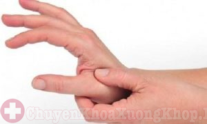 Làm gì khi bị đau khớp ngón tay sau khi sinh?