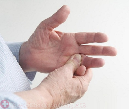 Thường xuyên đau khớp ngón tay khi ngủ dậy vào buổi sáng là bệnh gì