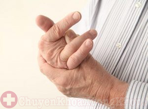Top 3 cây thuốc chữa đau khớp ngón tay bằng thuốc nam quanh nhà