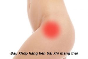 Bị đau khớp háng bên trái khi mang thai không nên chủ quan