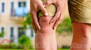 Bị tràn dịch khớp gối bao lâu thì khỏi và những điều cần lưu ý