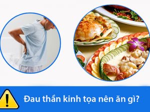 Tư vấn đau dây thần kinh tọa nên ăn gì và không nên ăn gì tốt?