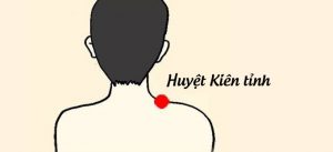 Huyệt Kiên Tỉnh