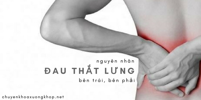 Những nguyên nhân nào gây đau thắt lưng bên trái, bên phải?
