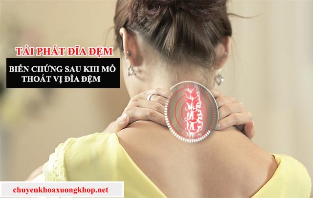 Biến chứng sau khi mổ thoát vị đĩa đệm là tái phát bệnh