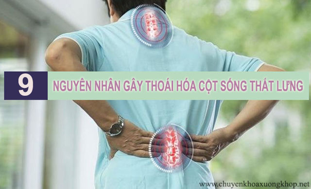 Nguyên nhân gây thoái hóa cột sống thắt lưng