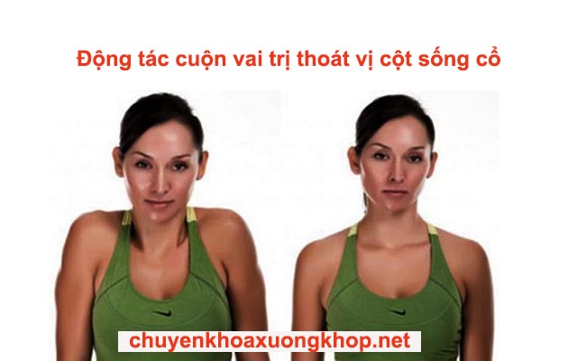 Vật lý trị liệu chữa thoát vị đĩa đệm cổ