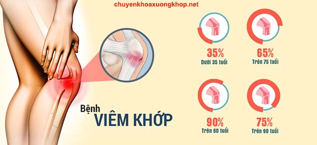 Bệnh viêm khớp gây đau nhức đầu gối chân trái - đau đầu gối trái là bệnh gì - đau đầu gối chân trái