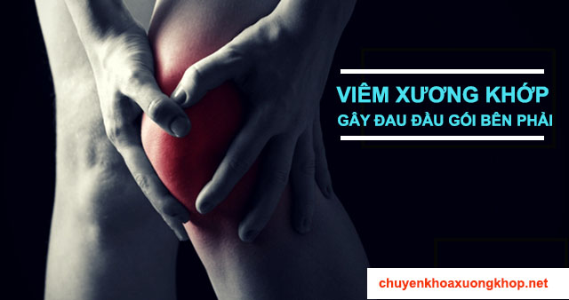 Viêm xương khớp gây đau đầu gối bên phải