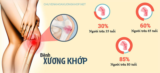 Tìm hiểu các bệnh về cơ xương khớp thường gặp