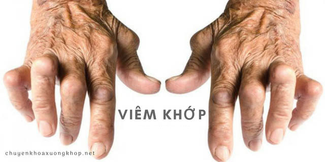 Các bệnh về xương khớp thường gặp