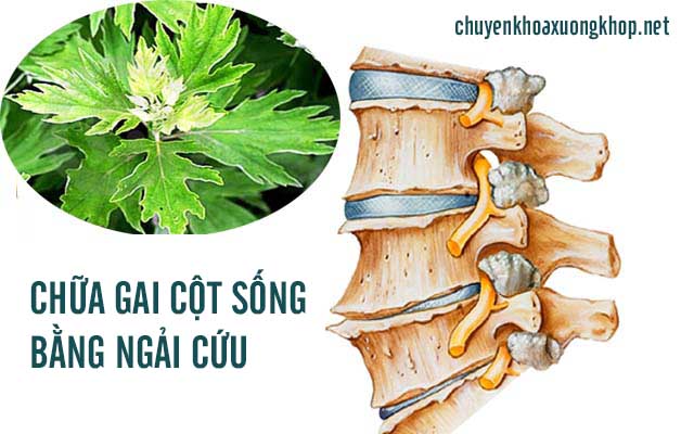 Chữa gai cột sống bằng cây ngải cứu