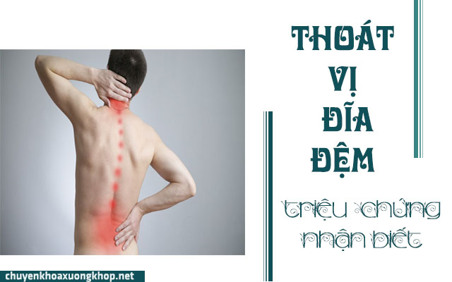 Dấu hiệu của bệnh thoát vị đĩa đệm cột sống