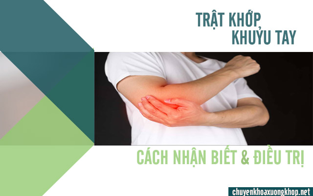 trật khớp khuỷu tay phải