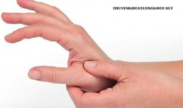 Triệu chứng thoái hóa khớp ngón tay