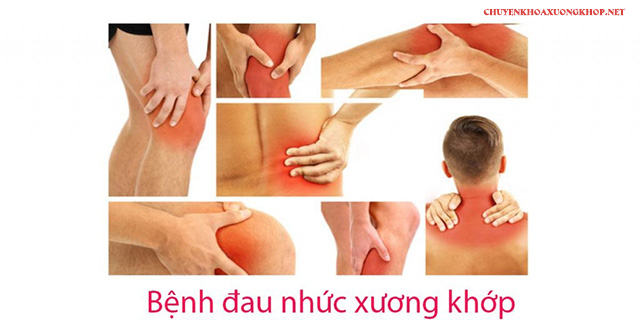 Cây đinh lăng chữa xương khớp