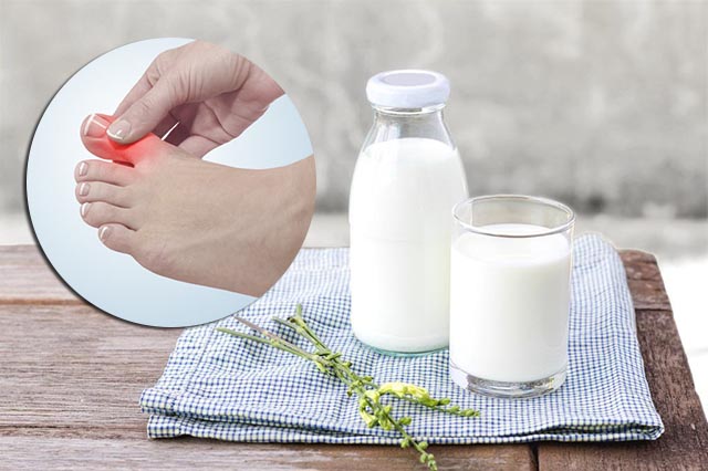 bị Gout có uống sữa được không bị Gout có uống sữa được không