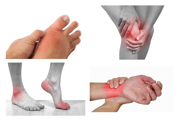 Triệu chứng viêm đau khớp
