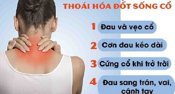 Biểu hiện thoái hóa đốt sống cổ