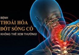 Dấu hiệu thoái hóa đốt sống cổ